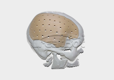 PEEK cranium implant02